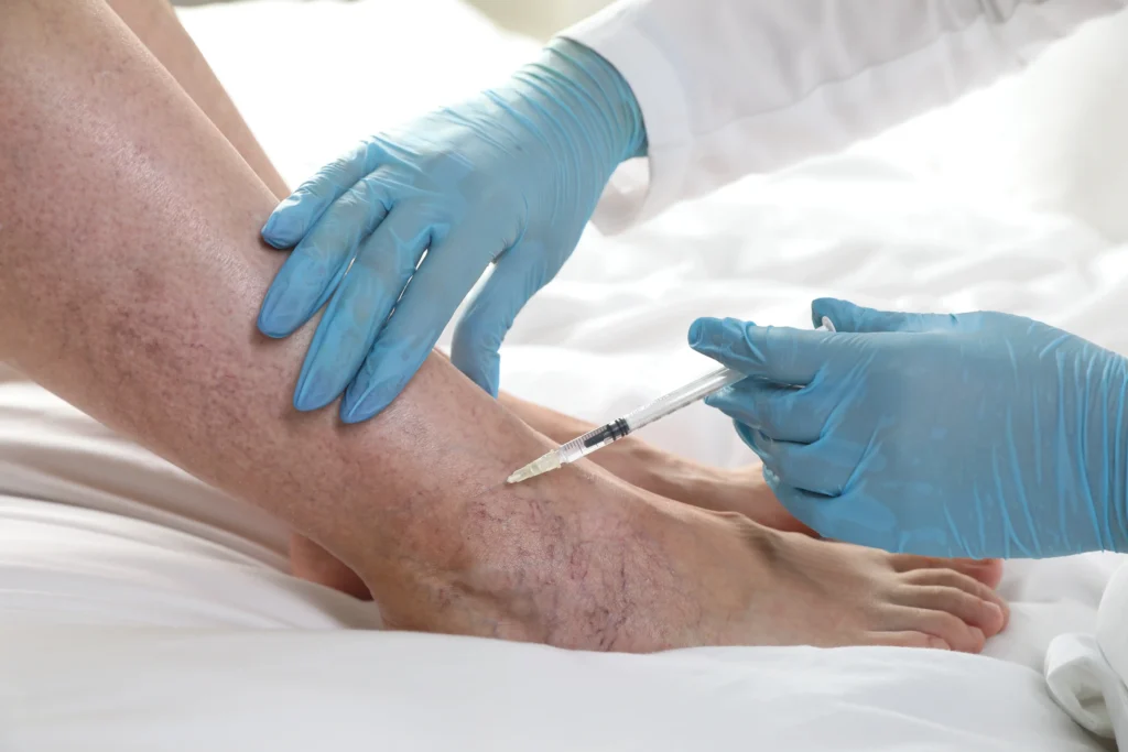 Say goodbye to spider veins in Cedar Park, TX