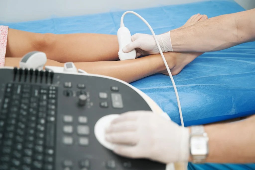 Say Goodbye to Spider Veins in Hamden, CT